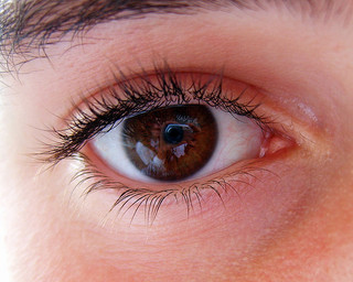 eye allergies